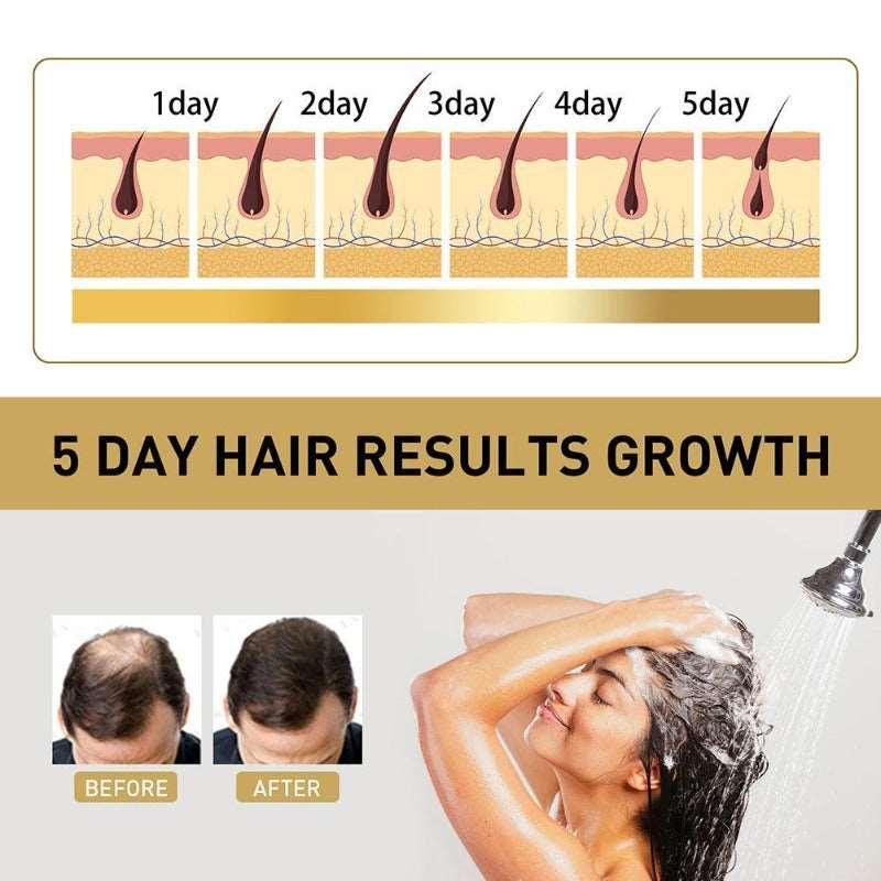 Hair Shampoo, Hair, Growth, Hair Loss, Scalp Treatments, Thinning Hair For Men And Women, 100ml, clouddiscoveries.com